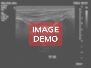 Comparison image - Case CV-ANT-G-A1099